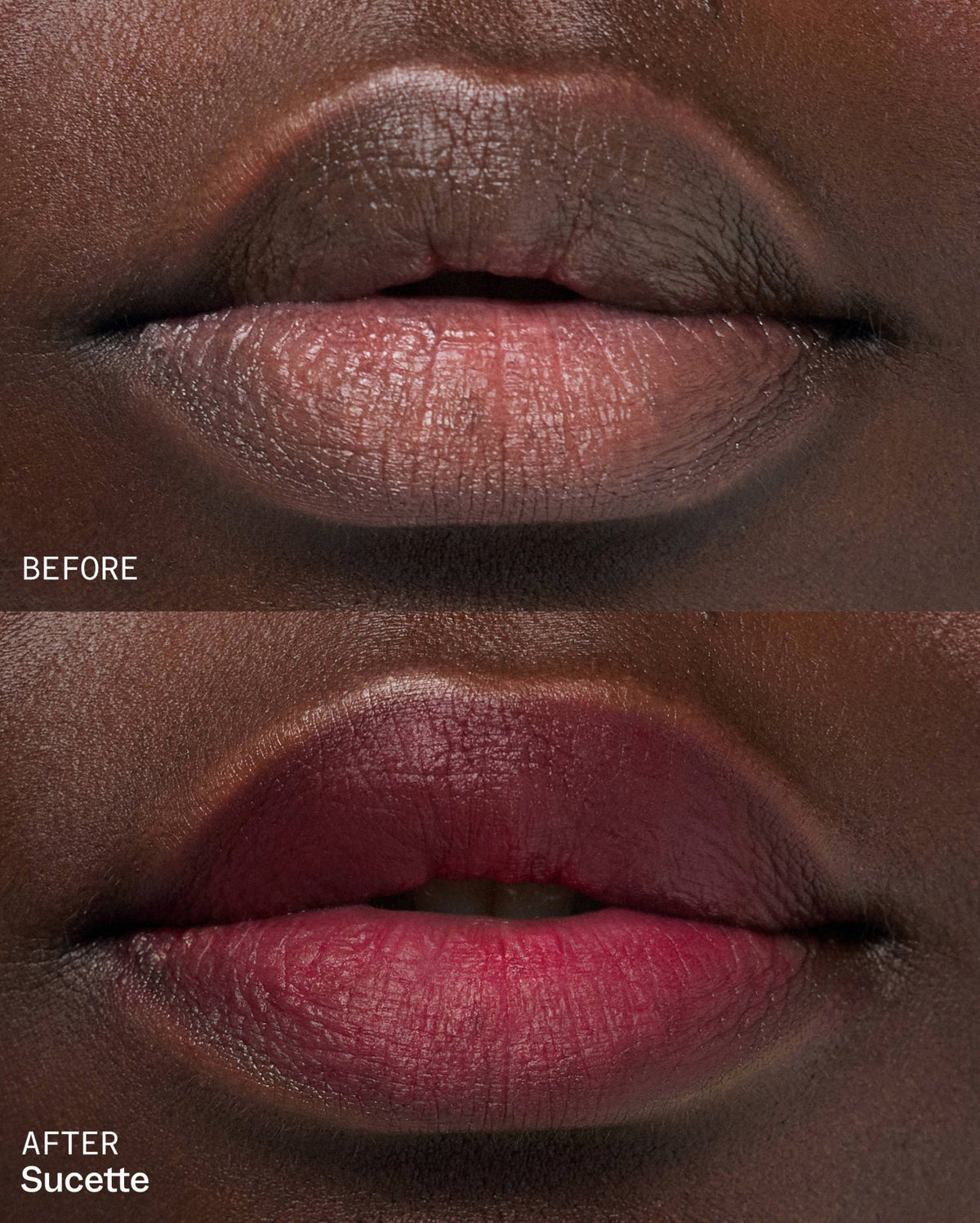 Bisou Balm - Sucette
